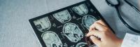 Doctor viewing patient brain scans